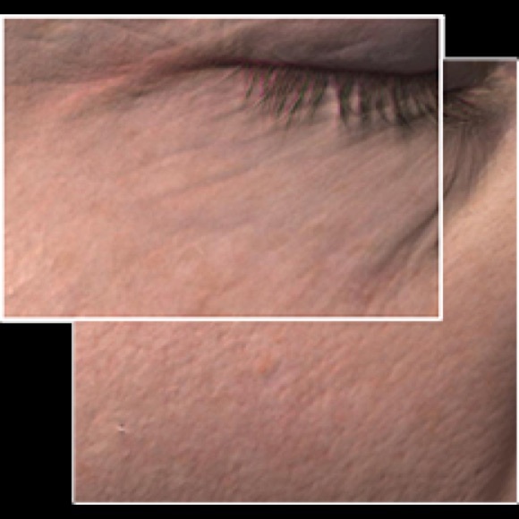 TimeWise® Miracle Set 3D™! - Picture 4 of 6